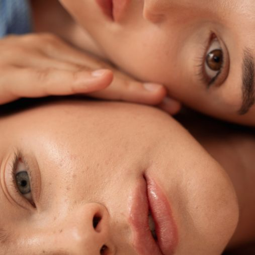 tratamento facial anti-manchas